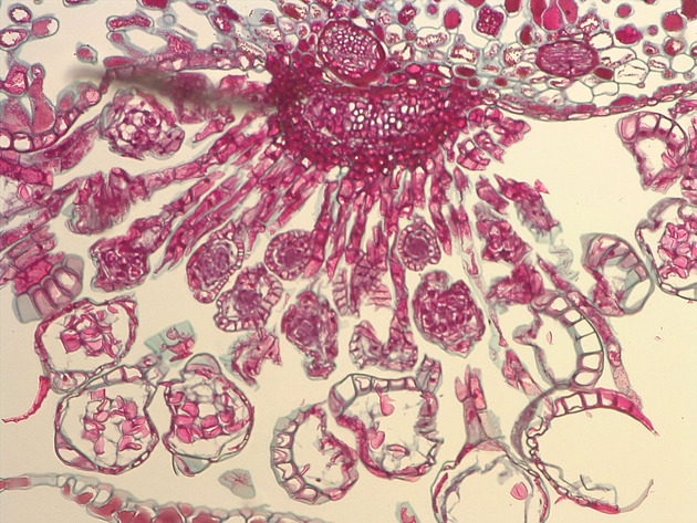 Mature Sporangia Slides - Mature Sporangia 01 100X